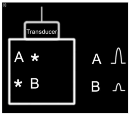 Question-img